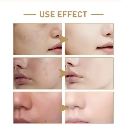 EELHOE Rice Face Toner – 150ml