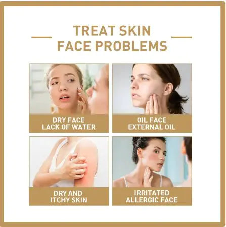 EELHOE Rice Face Toner – 150ml